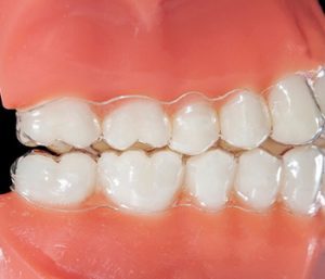 Dr oliviya heart, Virginia Biological Dentistry Proving affordable clear braces