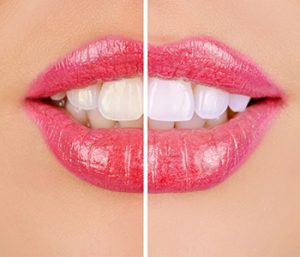 Dr oliviya heart, Virginia Biological Dentistry Describing Benefits Of Cosmetic Dentistry