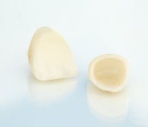 Blog 8 cerec one day crown from dentist in richmond, va