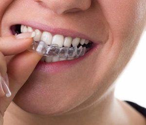 Dr oliviya heart, Virginia Biological Dentistry Proving Cost Of Clear Braces