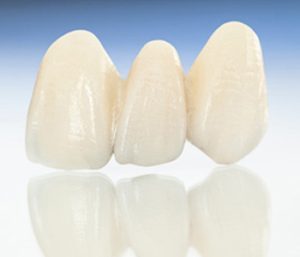 Blog 5 Dr oliviya heart, Virginia Biological Dentistry Providing tips of finding dentist