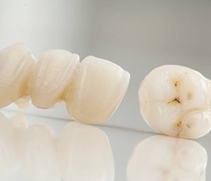 Blog 4 Same Day Crowns Near Me Glen Allen