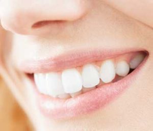 Blog 21 ALF appliance therapy , Virginia Biological Dentistry