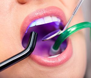 Blog 20 Laser Dentistry, Virginia Biological Dentistry