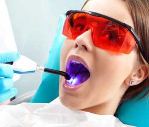 Laser dentistry treatment: A gentle approach to oral care in Glen Allen, VA 1 richmond va dentist offers gentle laser dentistry treatment img1
