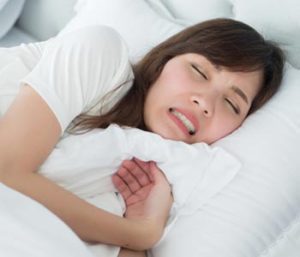 Occlusal Guard for Teeth Grinding in Glen Allen area