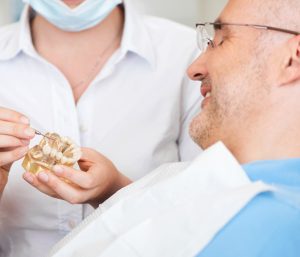 Blog 4 Dentures Dentist in Glen Allen VA Area
