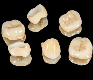 Blog 2 Teeth Crowns Service in Glen Allen VA Area