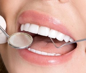 Dental Hygienist in Richmond Va area