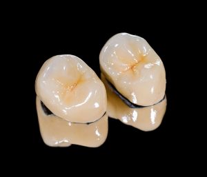 Blog 13 CEREC Crown Dentist Near Me in Glen Allen VA area